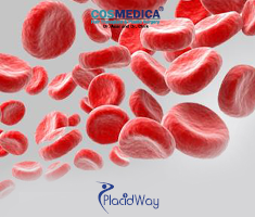 Slider image (10) Cosmedica Hair Transplant and Plastic Surgery